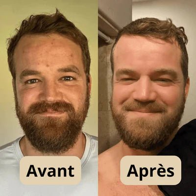 Peel Shot Coréen - Élimine les Impuretés et Sublime Votre Peau - Israa Ritual