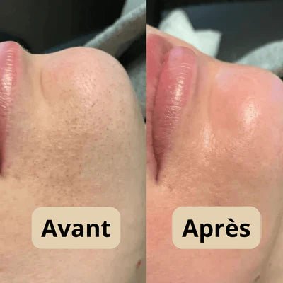 Peel Shot Coréen - Élimine les Impuretés et Sublime Votre Peau - Israa Ritual