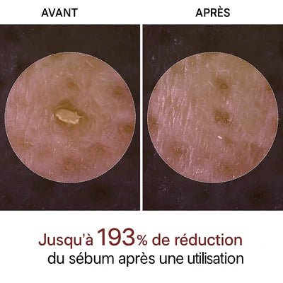 Peel Shot Coréen - Élimine les Impuretés et Sublime Votre Peau - Israa Ritual